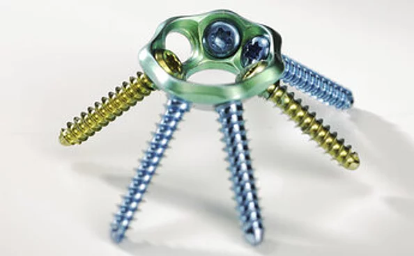 Mediokarpale Teilarthrodese FlowerPlate