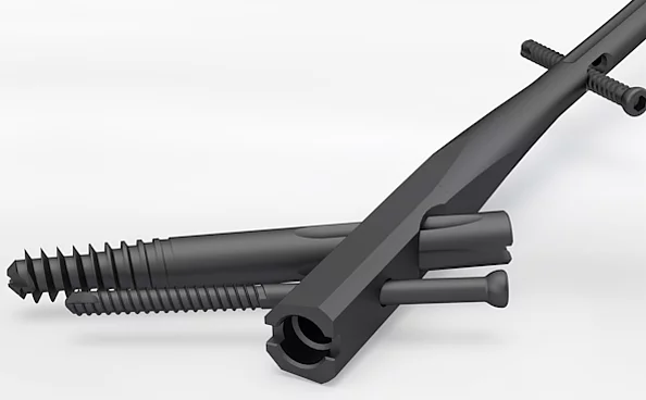 Elos – Intramedullärer Nagel für präzise Femurfrakturversorgung