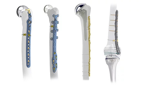 Periprothetische Versorgung