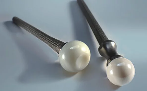 Ulnakopfprothese UHP