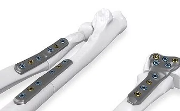 Patientenspezifisches Implantate IPS Implants®