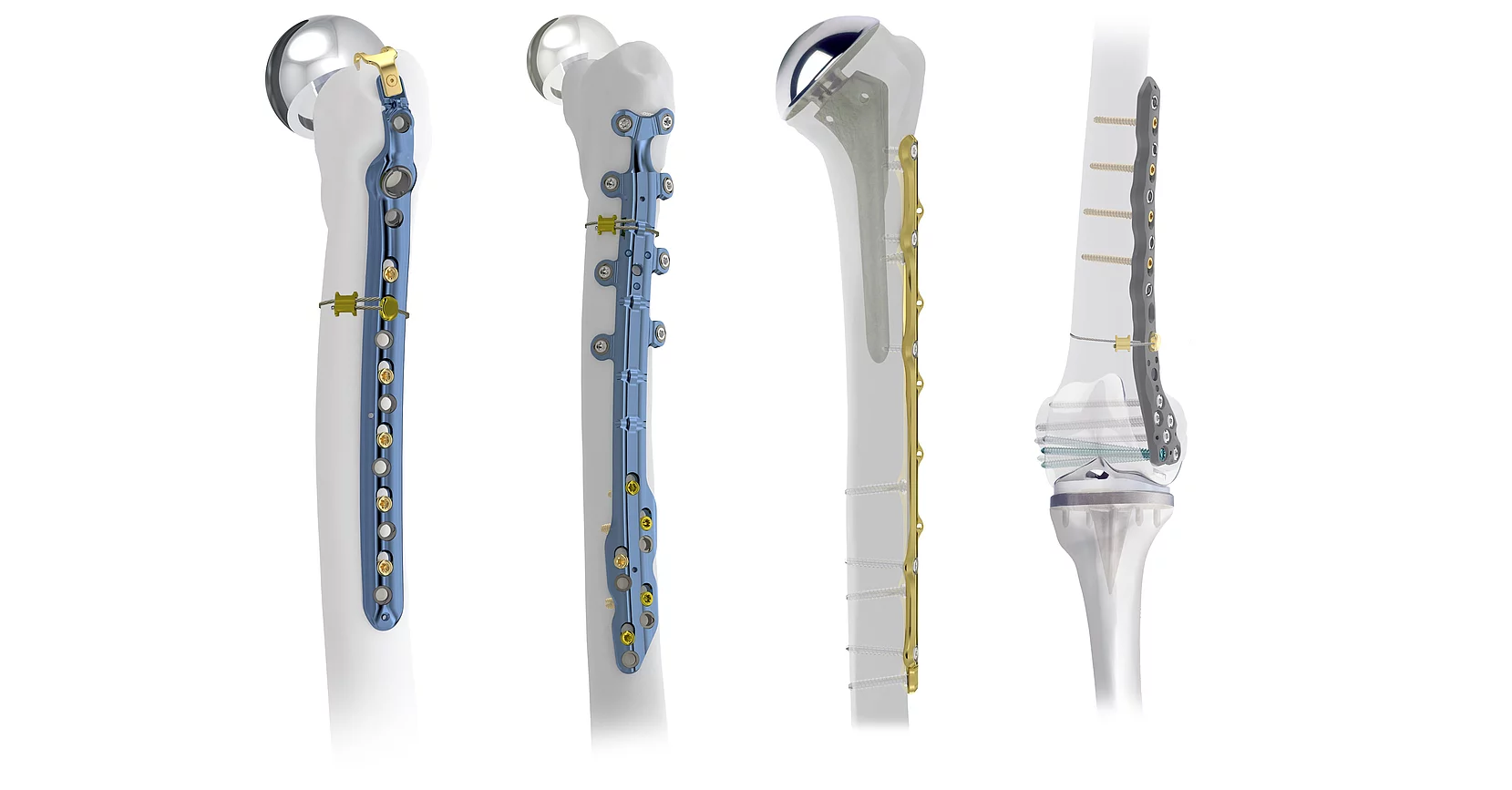 Periprothetische Versorgung