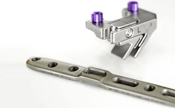 Ulnaverkürzungs- und Radiusrekonstruktionssystem Recos®