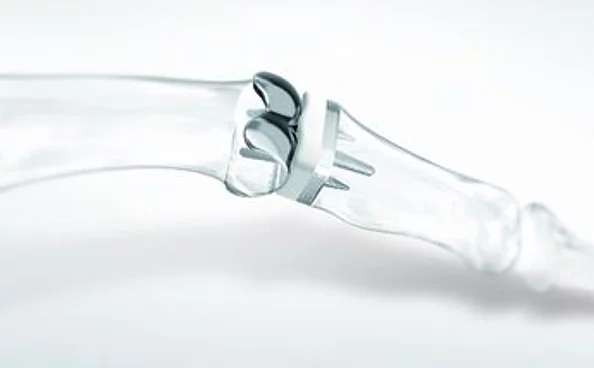 Gelenkersatz für das Fingermittelgelenk CapFlex PIP