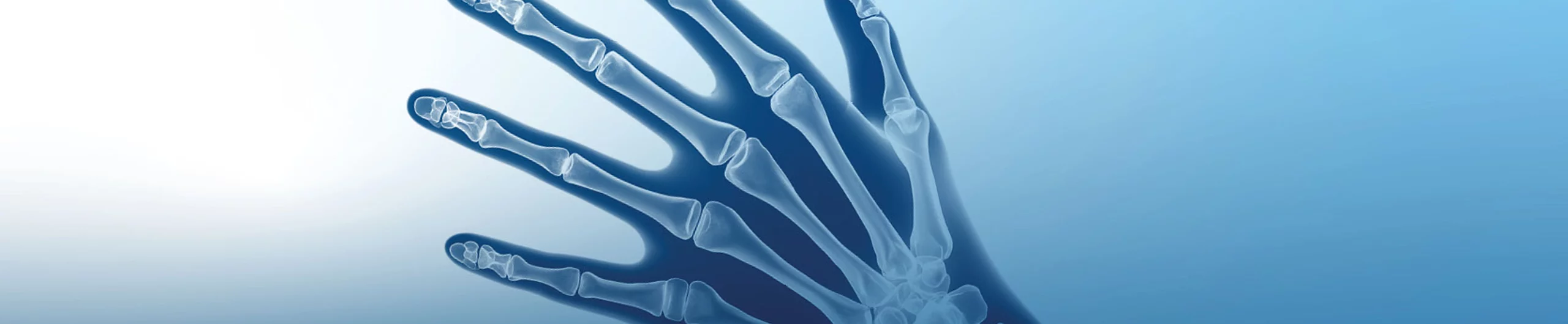 Obere Extremitäten Obere Extremitäten